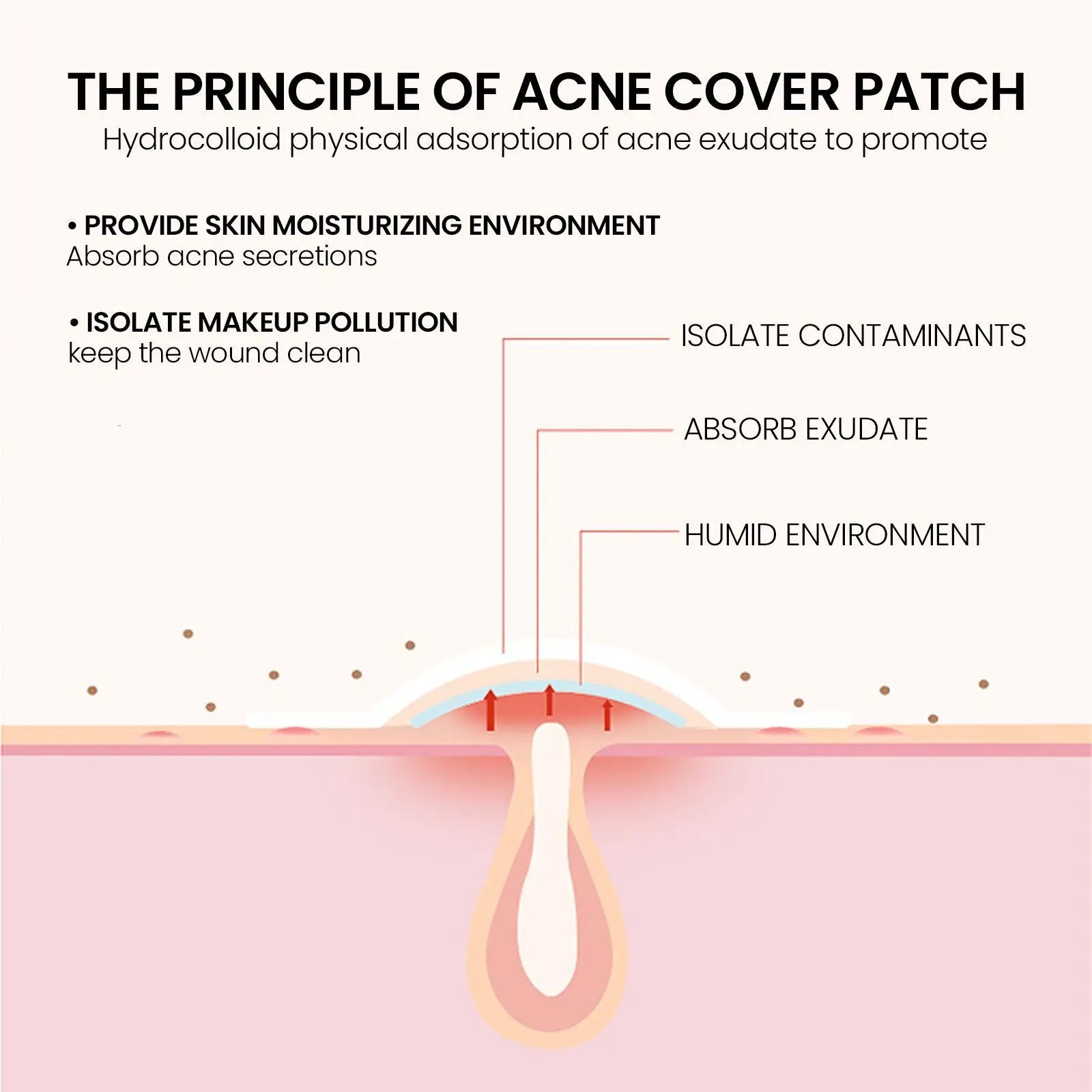 240 Pieces of Multi-Color Star Acne Patches, Facial Acne Patches, Concealer Acne Patches, and Pimples Patches, Ultra-Thin
